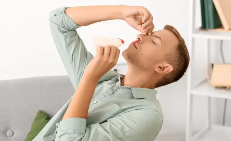 Mách bạn mẹo vặt chữa chảy máu cam đơn giản hiệu quả 