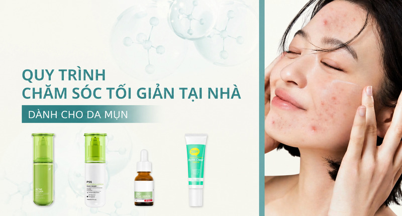 Da mụn nên chăm sóc tối giản, làm sạch kỹ và dùng sản phẩm đặc trị phù hợp. 