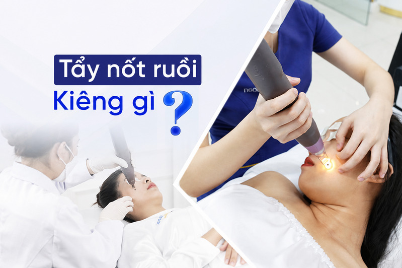 Hiểu rõ tẩy nốt ruồi kiêng gì giúp hạn chế thâm, sẹo, kích ứng và hỗ trợ vùng da phục hồi an toàn hơn.